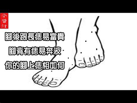 右腳踝內側有痣